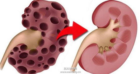 学起来 10种不花钱的补肾妙方
