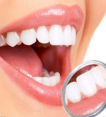 牙齿亮白形象好 哪些人不适合做牙齿美白