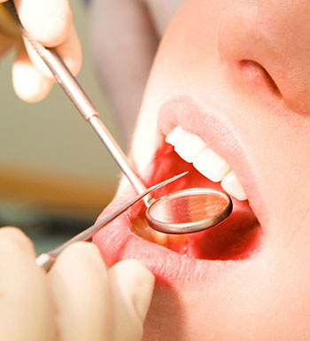 口腔健康常识 拔牙后需要注意哪些事项