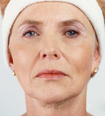 艾灸的作用 夏季艾灸治病最合适