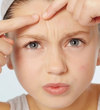 脸上为什么长痘痘 脸上长痘反映什么健康情况