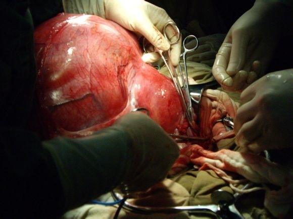 四大人工流产方式你知道吗