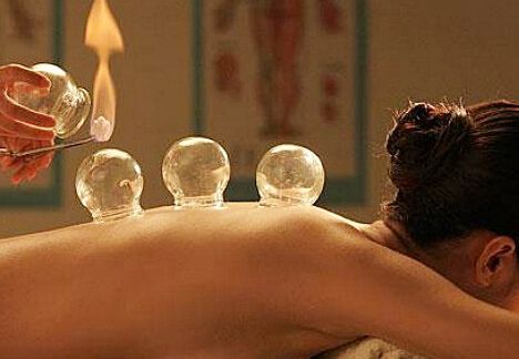 中医拔罐的种类以及功效你了解吗