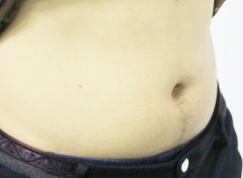 如何瘦肚子，教你怎么告别游泳圈