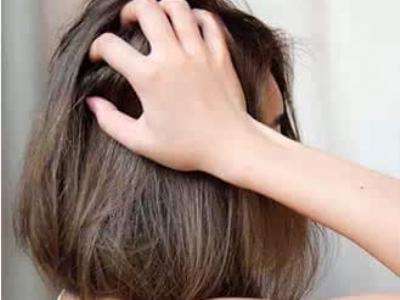 头发干枯怎么办 乌黑亮丽的头发你值得拥有