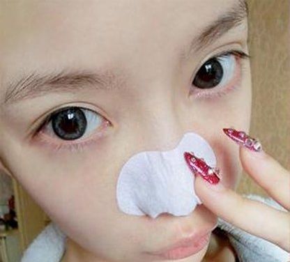 黑头克星来啦 如何去黑头