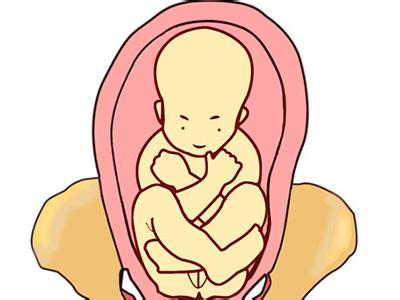 胎位不正的分类有哪些你都知道吗