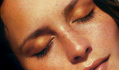 得了老年斑不可怕，老年斑有消除办法