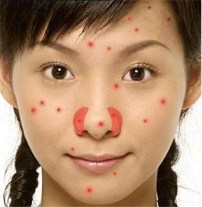 好脸面好面子 面部过敏怎么办