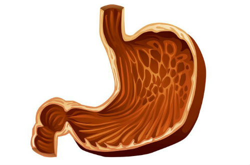 胃出血的症状 主要表现在三个方面