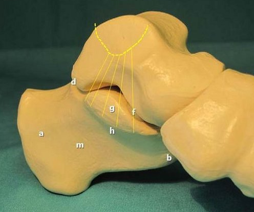 跟骨骨膜炎患者如何治疗更有效