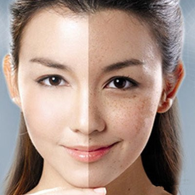 我有斗斑法宝，教你怎么自制祛斑面膜