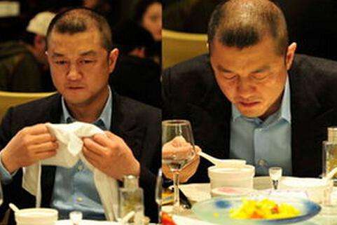 男性秃顶怎么办 生活习惯要注意