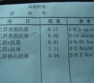 乙肝检查 为你详解乙肝的全套检查