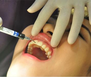 牙龈炎症状 这5大表现你要小心