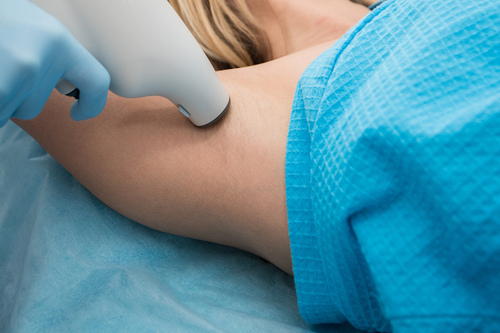 腋毛怎么处理 小编教您四个小方法