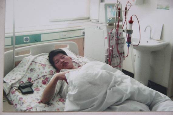 尿毒症有什么症状 这6个方面要注意