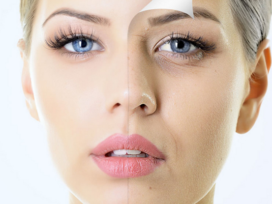 年轻人最想知道怎么样才能消除眼袋