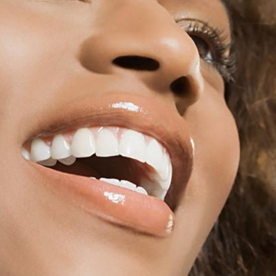 牙齿美白小窍门  七种方法