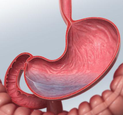 胃癌晚期症状与饮食禁忌介绍