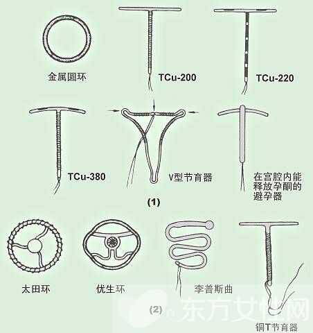 节育环哪种好 带你认识安环后的5大副作用