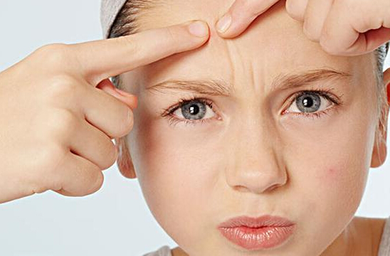 中医治疗痤疮的方法 痤疮病理病因分析