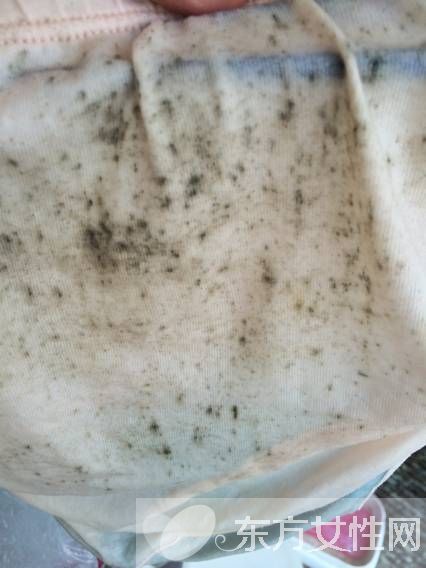 衣服发霉该如何清洗 3种简便方法一招搞定