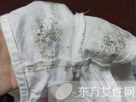 衣服发霉该如何清洗 3种简便方法一招搞定