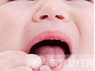 治口腔溃疡小妙招 口腔溃疡吃什么水果