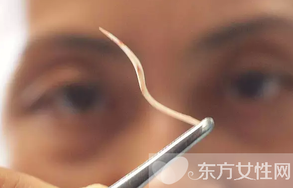 鱼刺卡住了怎么办 9种小妙招让你很快消除鱼刺