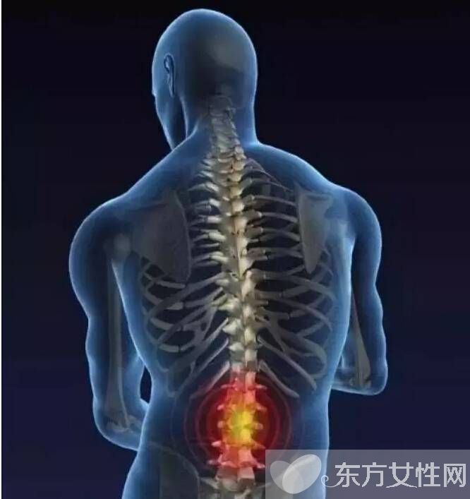 腰椎盘突出怎么锻炼 腰椎盘突出的4大病因