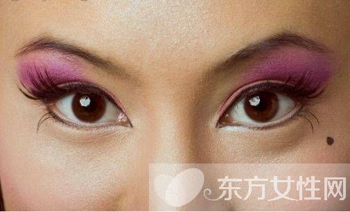 痣是怎么形成的 激光去痣后的6大护理方法