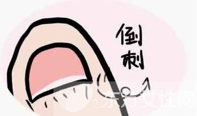 倒刺是什么 指甲倒刺的预防