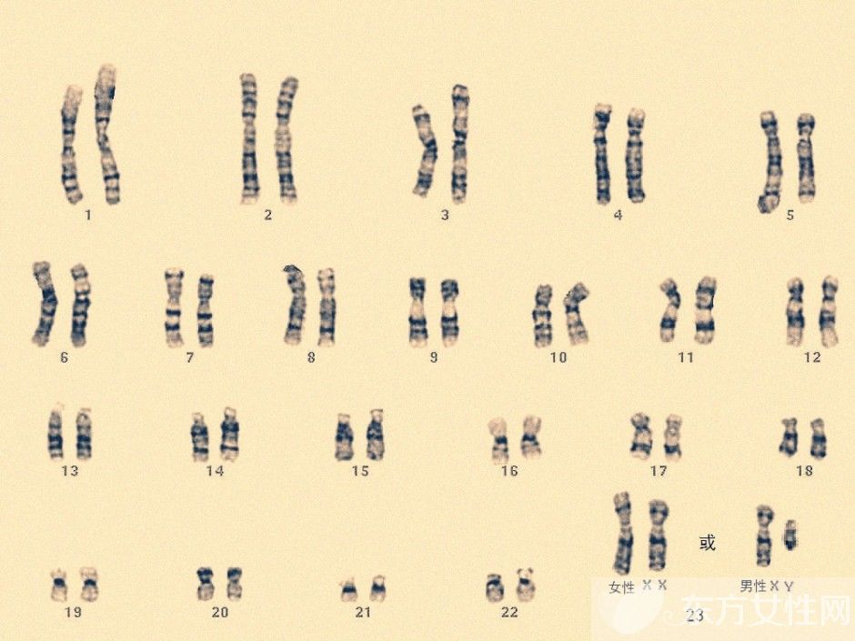 什么是染色体检查 如何降低染色体异常几率
