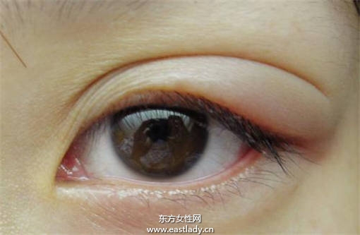 偷看别人洗澡会长针眼 科学让你知道为什么会长针眼