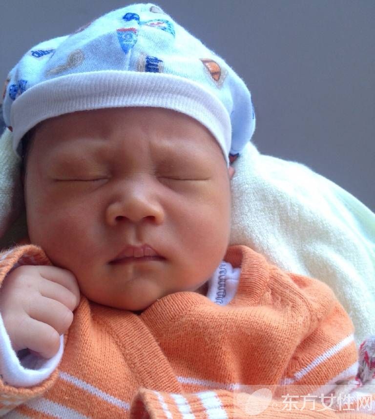 母乳性黄疸怎么治疗 如何预防婴儿母乳性黄疸