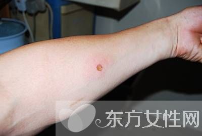 守宫砂是什么 守宫砂的历史传说