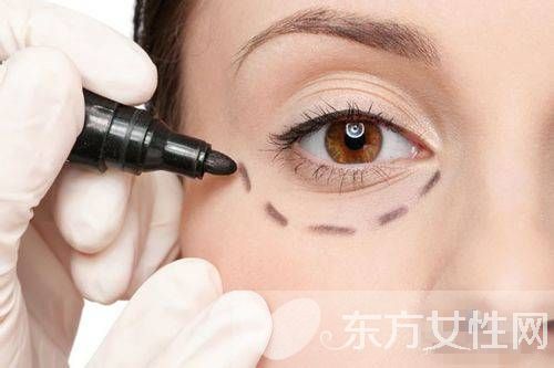 眼袋是怎么形成的 这些小妙招可以有效去除眼袋哦