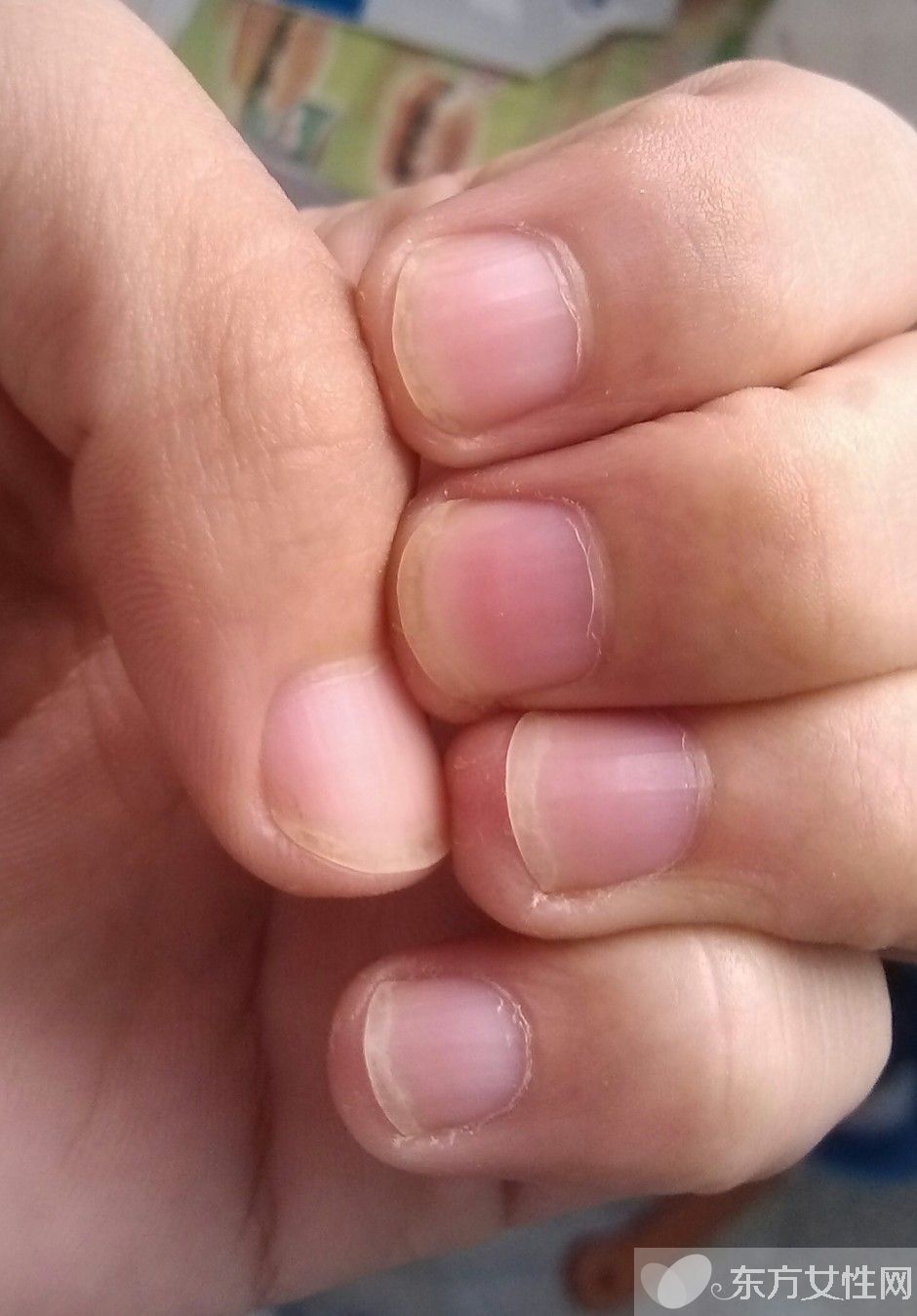 你健康吗 指甲半月痕反映你的健康状况