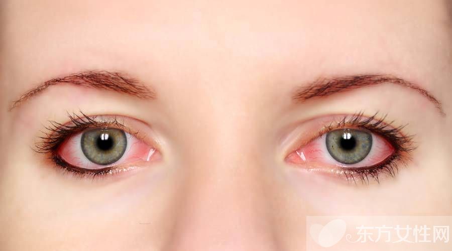 眼底充血是什么原因造成的 怎么快速治疗眼底充血