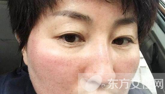 脸部色斑形成的原因 教你在家自制祛斑面膜