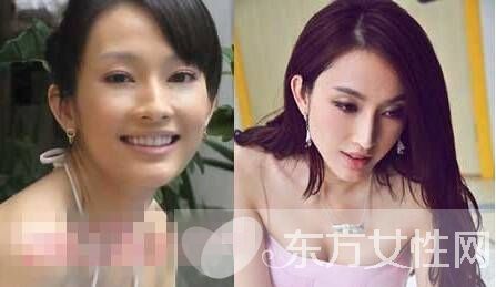 张俪王阳明分手真相 张丽个人资料整容照片遭扒