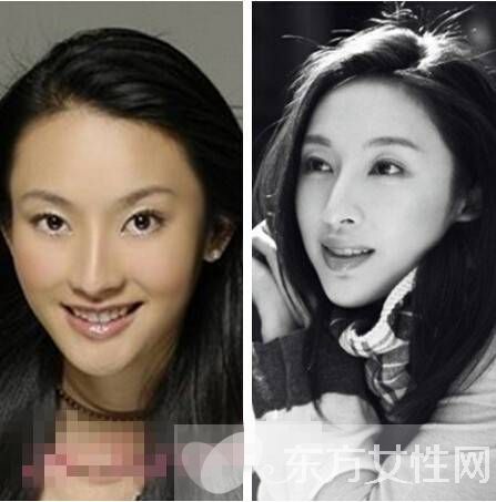 张俪王阳明分手真相 张丽个人资料整容照片遭扒