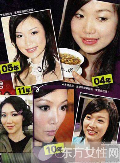 赵薇老公前女友叶翠翠图片 整容前后照遭吐槽变化惊人