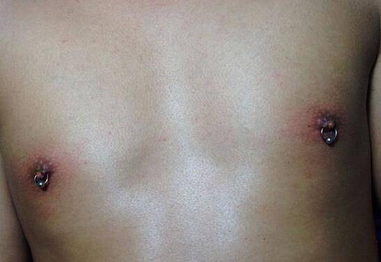 张靓颖打乳环囧照曝光 打乳环到底是个什么鬼