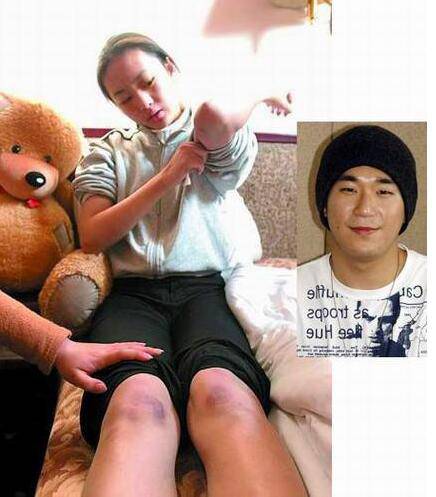 周小北扮演者童瑶个人资料 揭童瑶被打真相