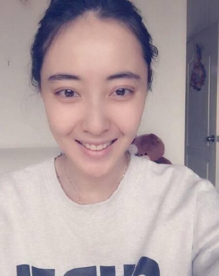 米露个人资料大揭秘 米露脸上有疤是怎么回事