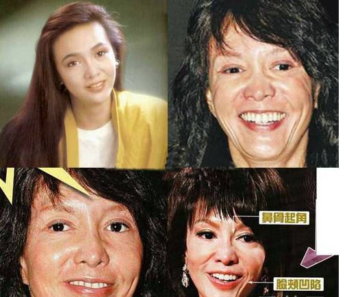 郑裕玲整容前后照片吓死人 郑裕玲个人资料曝光
