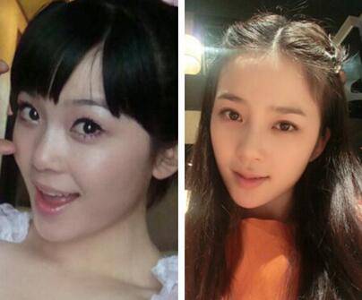 赵韩樱子整容前后对比照遭扒 她是哪国人呢
