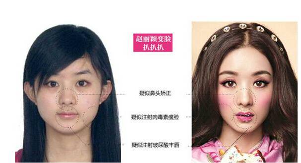 揭赵丽颖骂杨幂真相 赵丽颖整容前后对比